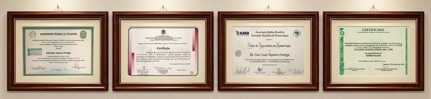 Certificados de formação do Dr. Caio Formiga: Diploma UFT 2014, Residência Médica HFB 2018, Título de Especialista AMB/SBD 2018 e RQE 2226 CRM-TO 2018.